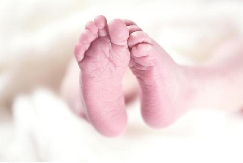 Nace una niña con dos cabezas en Bangladesh (FOTO)