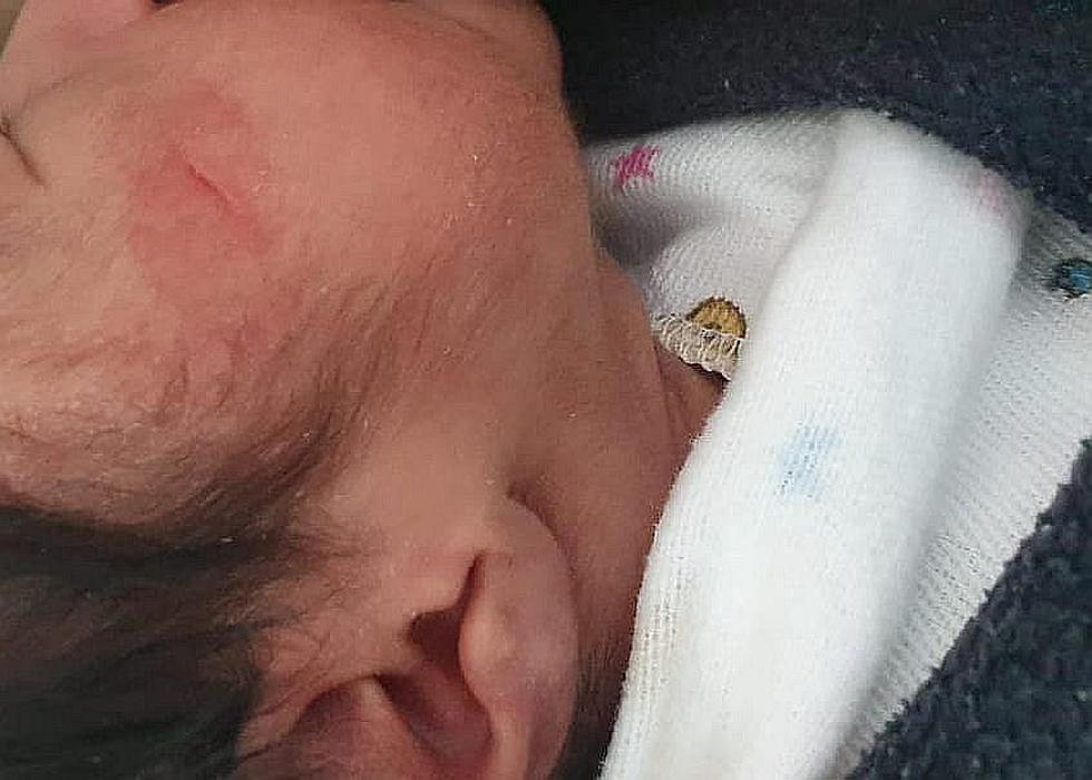 Padre denuncia que médico le cortó rostro a recién nacida con bisturí