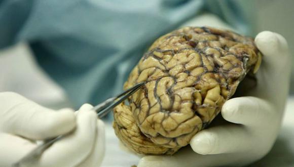 Descubren tratamiento efectivo para el cáncer de cerebro más mortal