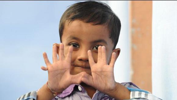 Niño de 25 dedos goza de fama en la India