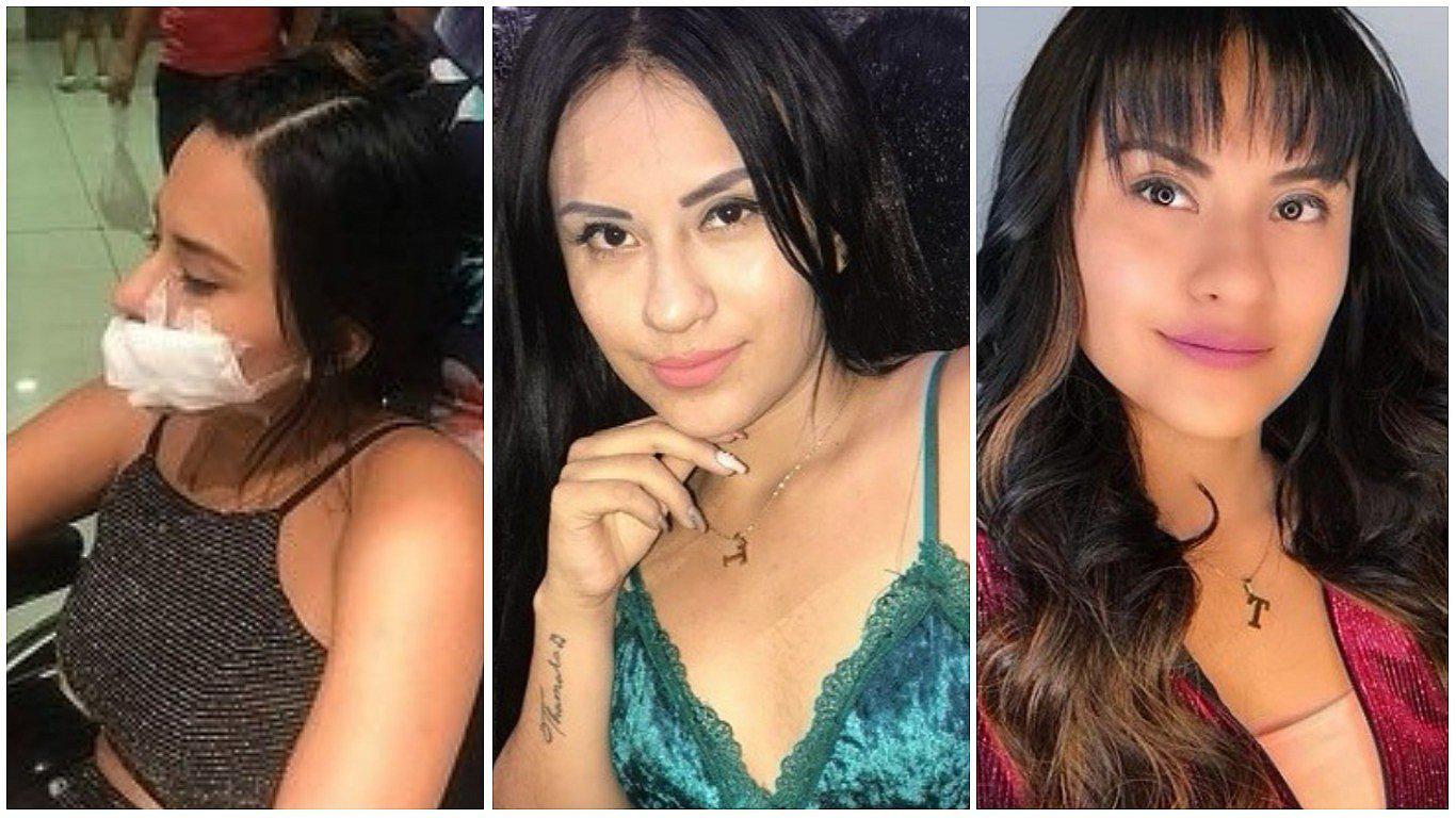 Thamara Gómez se pronuncia sobre lesión que sufrió tras accidente con hacha (FOTO)