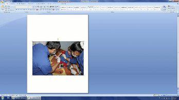 Apoyo para "niño mariposa" en SJL