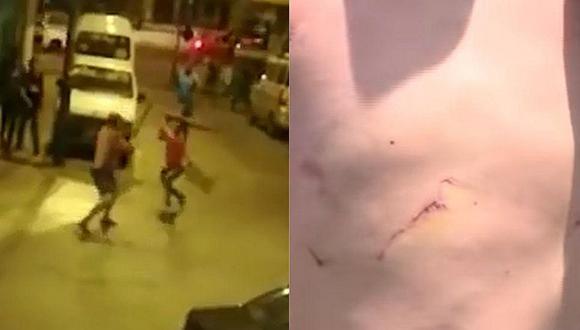 Hombre fue brutalmente atacado por extranjeros que estaban haciendo bulla en la calle