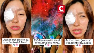TikTok: Joven sufre daño en el ojo por pirotécnicos del concierto de Karol G en Lima