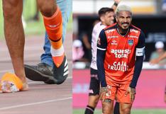 ¿Se lesionó? El preocupante estado en que quedó el tobillo de Paolo Guerrero tras sufrir dura falta (FOTOS)