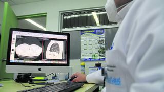 Pacientes llegan a hospital de Huancayo con el 80% de pulmones dañados por COVID-19