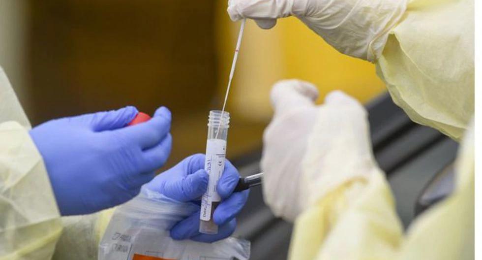 Nuestro país recibió la donación de 10.000 pruebas moleculares de coronavirus por parte del Gobierno de la República Popular China. (Foto: Getty)