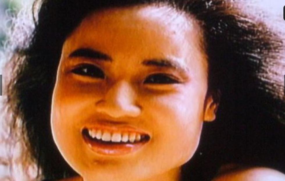 Así quedó exmodelo por obsesión a las cirugías