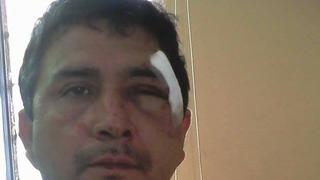 Chimbote: Acusan a “Los Patecos” de desfigurar a un policía