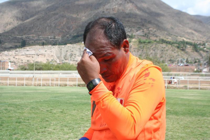 Violencia en la Copa Perú